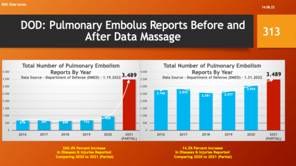 DoD: Pulmonary Embolus Before and After Data Massage